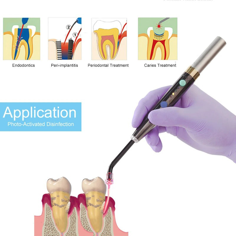 Wireless F3WW Dental Diode Las - đánh giá và giá Photography Lighting Equipment