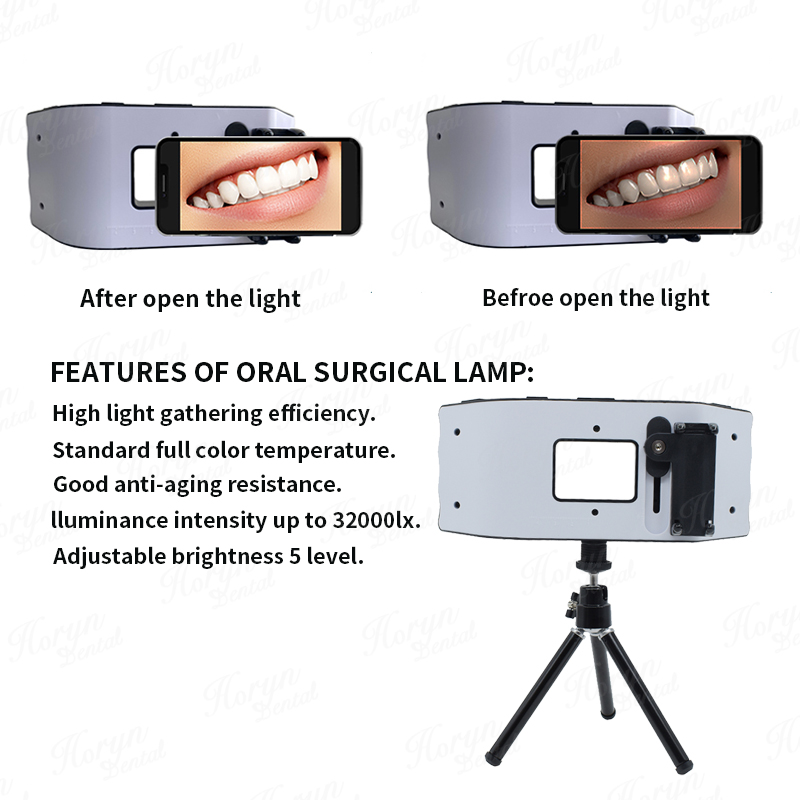 Dental Flash Light Photography - đánh giá và giá Photography Lighting Equipment